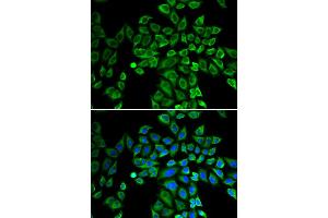 Immunofluorescence analysis of HeLa cell using ANGPT2 antibody. (Angiopoietin 2 Antikörper)