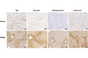 HBcAg- and HBsAg-expressing hepatocytes in individual mouse livers were stained with DAB (HBsAg with ABIN285516). (HBSAg Antikörper)