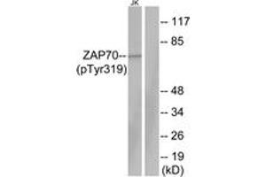 Western blot analysis of extracts from Jurkat cells, using ZAP-70 (Phospho-Tyr319) Antibody. (ZAP70 Antikörper  (pTyr319))