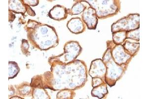 Immunohistochemistry (IHC) image for anti-Thrombomodulin (THBD) (AA 69-194) antibody (ABIN4949900)