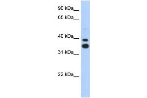 WB Suggested Anti-MSX2 Antibody Titration: 0. (Msx2/Hox8 Antikörper  (N-Term))