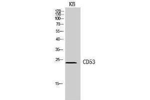 Western Blotting (WB) image for anti-CD53 (CD53) (Internal Region) antibody (ABIN3178937) (CD53 Antikörper  (Internal Region))