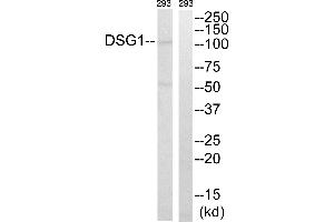 Western blot analysis of extracts from 293 cells, using DSG1 antibody. (Desmoglein 1 Antikörper  (Internal Region))