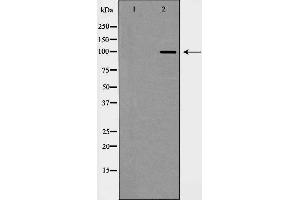 Western blot analysis of CDH2 expression in Jurkat cells,The lane on the left is treated with the antigen-specific peptide. (N-Cadherin Antikörper  (C-Term))