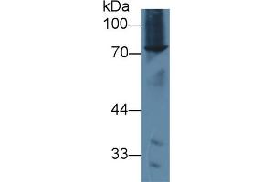 Detection of ABCD2 in Mouse Spleen lysate using Polyclonal Antibody to ATP Binding Cassette Transporter D2 (ABCD2) (Abcd2 Antikörper  (AA 501-695))