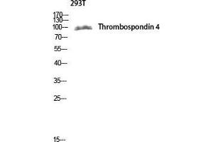 Western Blot (WB) analysis of 293T lysis using Thrombospondin 4 antibody. (THBS4 Antikörper  (Internal Region))