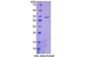 SDS-PAGE analysis of Human CHRNb2 Protein. (CHRNB2 Protein)