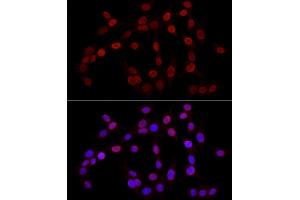 Immunofluorescence (IF) image for anti-Histone 3 (H3) (H3K27me) antibody (ABIN3023269)