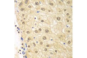 Immunohistochemistry of paraffin-embedded human liver injury using PSMD2 antibody. (PSMD2 Antikörper)