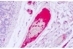 Anti-VWF antibody IHC staining of human intravascular plasma. (VWF Antikörper)