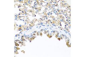 Immunohistochemistry of paraffin-embedded mouse lung using PI3 antibody (ABIN5974984) at dilution of 1/100 (40x lens). (PI3 Antikörper)