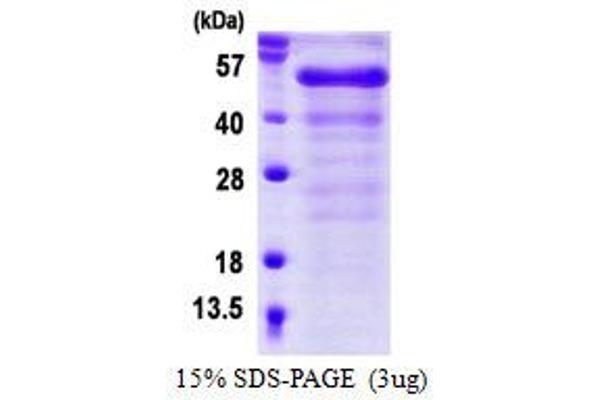 FGFR1OP Protein (His tag)