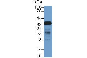 Detection of CD40L in Rat Lymph node lysate using Polyclonal Antibody to Cluster Of Differentiation 40 Ligand (CD40L) (CD40 Ligand Antikörper  (AA 48-244))