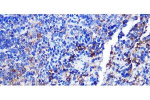 Immunohistochemistry of paraffin-embedded Mouse spleen using CD68 Polyclonal Antibody at dilution of 1:100 (40x lens). (CD68 Antikörper)