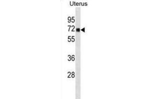 Western Blotting (WB) image for anti-tRNA Methyltransferase 1 (TRMT1) antibody (ABIN3000964) (TRMT1 Antikörper)