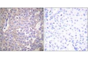 Immunohistochemistry (IHC) image for anti-Claudin 2 (CLDN2) (AA 181-230) antibody (ABIN2889174) (Claudin 2 Antikörper  (AA 181-230))