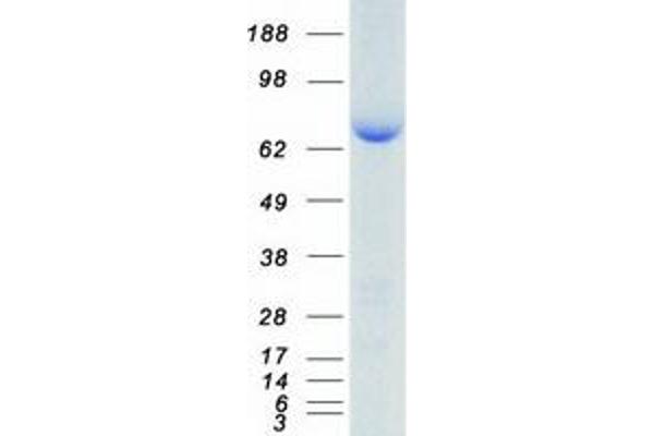 HSP90AB1 Protein (Myc-DYKDDDDK Tag)