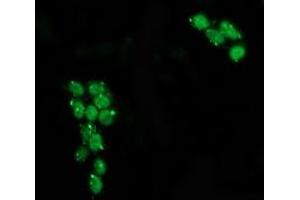 Anti-TP53 mouse monoclonal antibody (ABIN2454502) immunofluorescent staining of COS7 cells transiently transfected by pCMV6-ENTRY TP53 (RC200003). (p53 Antikörper)