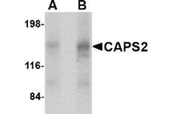 CADPS2 Antikörper  (Center)