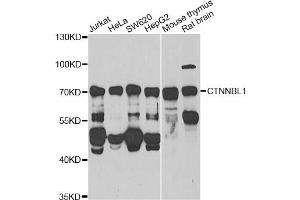 Western blot analysis of extracts of various cell lines, using CTNNBL1 Antibody (ABIN2562062) at 1:1000 dilution. (CTNNBL1 Antikörper)