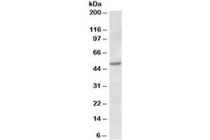 Western blot testing of human placenta lysate with Estrogen receptor beta antibody at 1ug/ml. (ESR2 Antikörper)