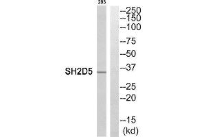 Western Blotting (WB) image for anti-SH2 Domain Containing 5 (SH2D5) (C-Term) antibody (ABIN1852147) (SH2D5 Antikörper  (C-Term))