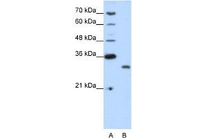 WB Suggested Anti-CPXCR1 Antibody Titration:  1. (CPXCR1 Antikörper  (N-Term))