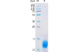 Human Protein, His Tag on SDS-PAGE under reducing condition. (MUC1 Protein (AA 1036-1156) (His tag))