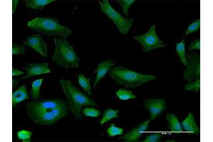 Immunofluorescence of purified MaxPab antibody to ITGAX on HeLa cell. (CD11c Antikörper  (AA 1-1169))