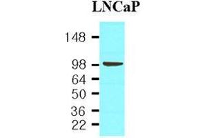 Cell lysates of LnitrocelluloseaP(30 ug) were resolved by SDS-PAGE, transferred to nitrocellulose membrane and probed with anti-human PSMA (1:1,000). (PSMA Antikörper  (AA 117-351))