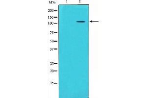 Western blot analysis on mouse brain lysate using GluR5 Antibody,The lane on the left is treated with the antigen-specific peptide. (GRIK1 Antikörper  (Internal Region))