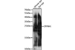 Western blot analysis of extracts of various cell lines, using CRYBA1 antibody (ABIN6291831) at 1:1000 dilution. (CRYBA1 Antikörper)