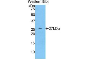 Western Blotting (WB) image for anti-Glutathione S-Transferase mu 1 (GSTM1) (AA 1-218) antibody (ABIN1859091) (GSTM1 Antikörper  (AA 1-218))