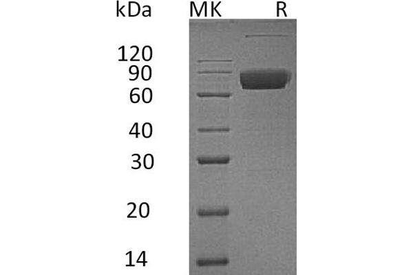 IL10RB Protein (Fc Tag)
