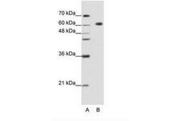 GMEB2 Antikörper  (C-Term)