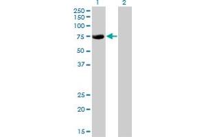 Western Blot analysis of CBFA2T2 expression in transfected 293T cell line by CBFA2T2 monoclonal antibody (M15), clone 2C10. (CBFA2T2 Antikörper  (AA 201-304))