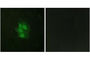 Immunofluorescence analysis of HeLa cells, using p53 (Phospho-Ser392) Antibody. (p53 Antikörper  (pSer392))