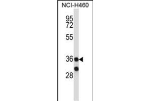 RCH11 Antibody (C-term) (ABIN657732 and ABIN2846717) western blot analysis in NCI- cell line lysates (35 μg/lane). (MARCH11 Antikörper  (C-Term))