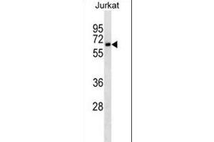 CD25 Antibody ABIN1539791 western blot analysis in Jurkat cell line lysates (35 μg/lane). (CD25 Antikörper)