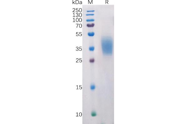PDCD1LG2 Protein (AA 20-219) (His tag)