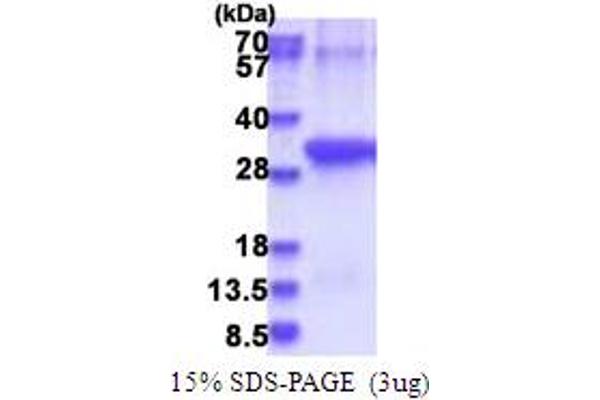 ANTXR2 Protein (AA 34-317) (His tag)