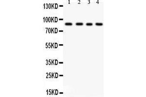 Anti- IKK beta antibody, Western blotting All lanes: Anti IKK beta  at 0. (IKBKB Antikörper  (AA 398-756))