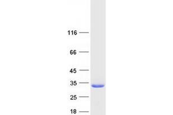 TPK1 Protein (Transcript Variant 1) (Myc-DYKDDDDK Tag)