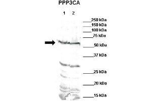 WB Suggested Anti-PPP3CA Antibody    Positive Control:  Lane 1: 80ug mouse brain extractLane 2: 80ug rat brain extract  Primary Antibody Dilution :   1:500  Secondary Antibody :  IRDye 800 CW goat anti-rabbit from Li-COR Bioscience  Secondry Antibody Dilution :   1:20,000  Submitted by:  Dr. (PPP3CA Antikörper  (N-Term))