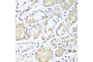 Immunohistochemistry of paraffin-embedded human stomach using RPH3AL antibody. (RPH3AL Antikörper  (AA 161-315))