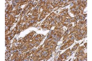 Immunohistochemistry (IHC) image for anti-Vimentin (VIM) antibody (ABIN2854814)