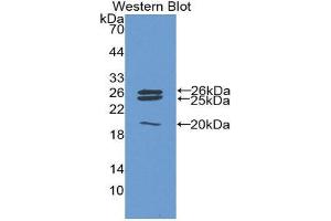 Western Blotting (WB) image for anti-Catalase (CAT) (AA 246-366) antibody (ABIN1858260) (Catalase Antikörper  (AA 246-366))