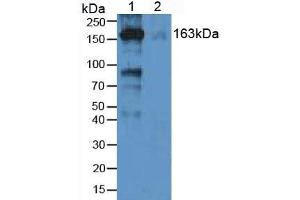 Western Blotting (WB) image for alpha-2-Macroglobulin (A2M) ELISA Kit (ABIN6574245)