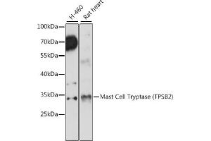 Western blot analysis of extracts of various cell lines, using Mast Cell Tryptase (Mast Cell Tryptase (TPSB2)) antibody (ABIN7271018) at 1:1000 dilution. (TPSB2 Antikörper  (AA 1-275))