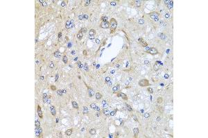 Immunohistochemistry of paraffin-embedded rat brain using CXCR4 antibody at dilution of 1:100 (x40 lens). (CXCR4 Antikörper)